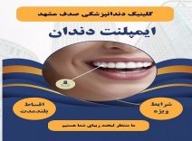 ایمپلنت دندان با کیفیت بالا و پرداخت اقساطی در کلی